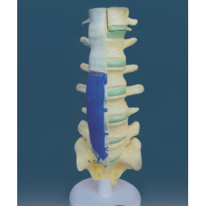 Lumbar Vertical Column Model